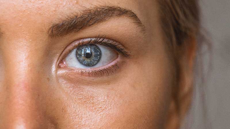 how-to-treat-pink-eye-at-home