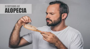 Signs You Might Have Alopecia