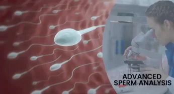 Want to Know the Reason for Failed Conception? Go for an Advanced Sperm Analysis.