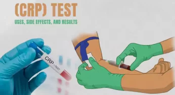 C-Reactive Protein (Crp) Test: Uses, Side Effects, And Results